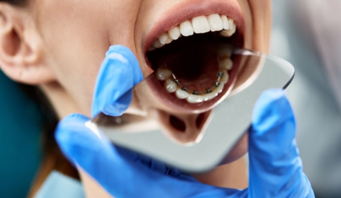 Treatment -  Dr Nina Shaffie