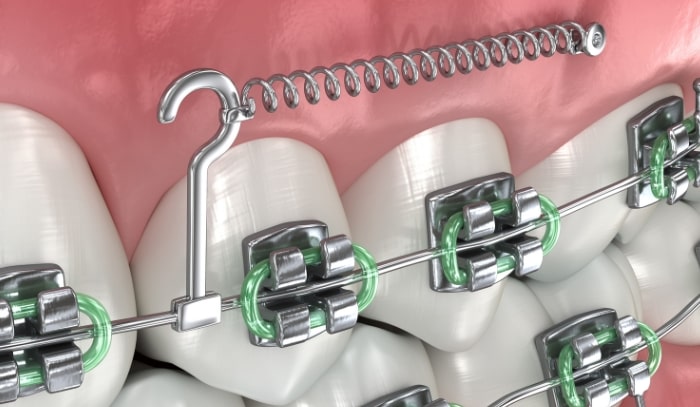 Treatment -  Dr Nina Shaffie