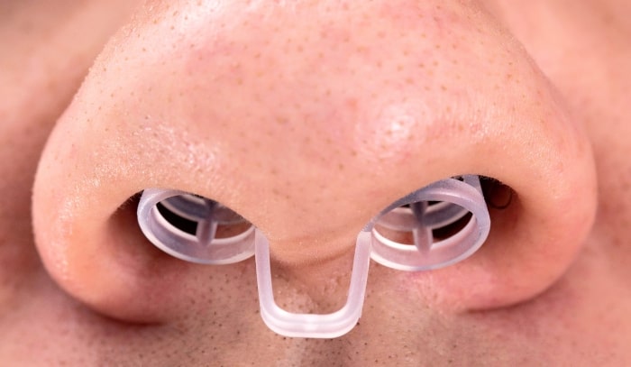 Treatment -  Dr Nina Shaffie