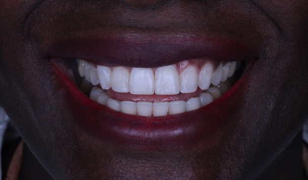 After -Dr Nina Shaffie