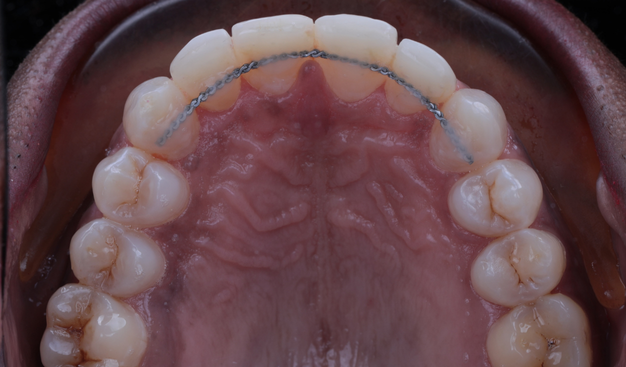 After -Dr Nina Shaffie