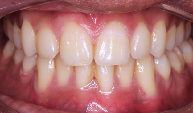 After -Dr Nina Shaffie