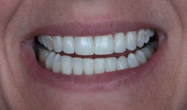 After -Dr Nina Shaffie