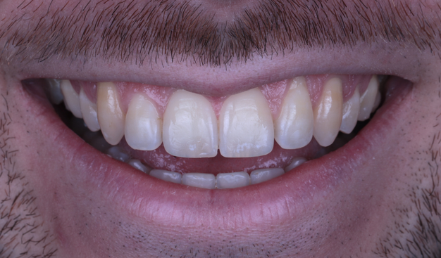 After -Dr Nina Shaffie