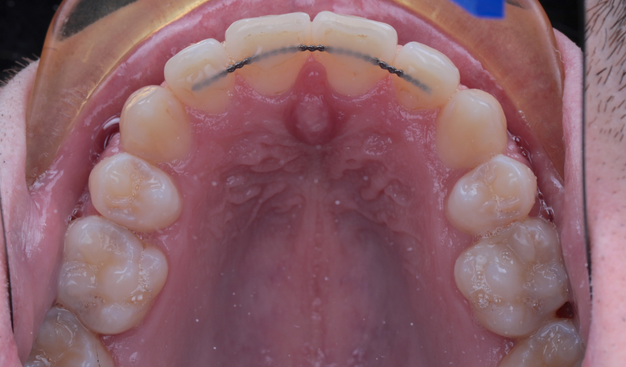 After -Dr Nina Shaffie