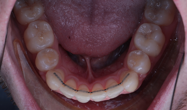 After -Dr Nina Shaffie