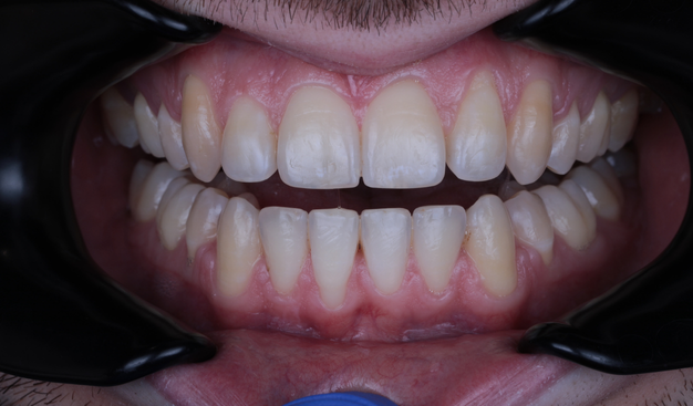 After -Dr Nina Shaffie