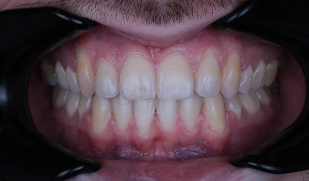 After -Dr Nina Shaffie