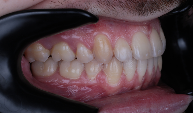 After -Dr Nina Shaffie