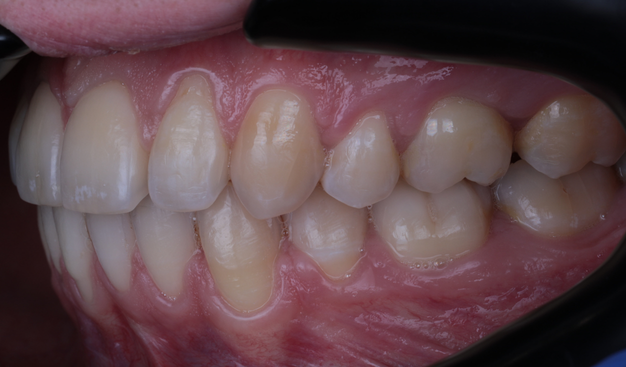 After -Dr Nina Shaffie