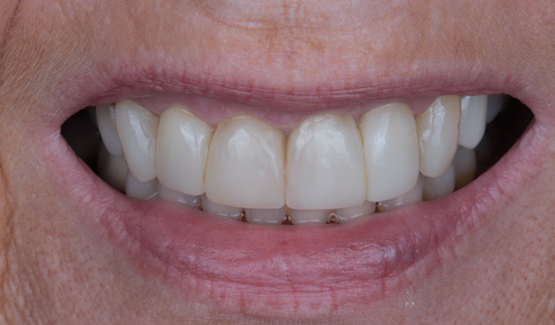 After -Dr Nina Shaffie