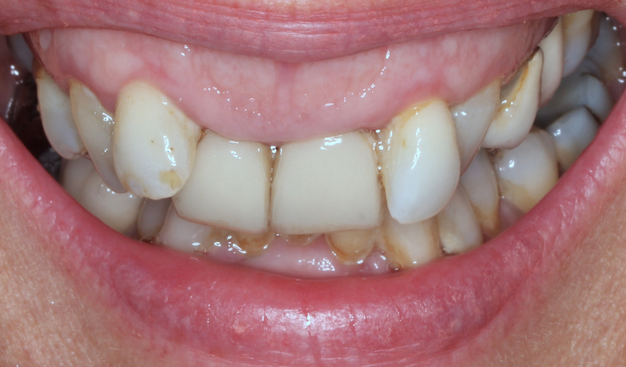 After -Dr Nina Shaffie