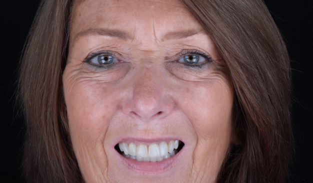 After -Dr Nina Shaffie