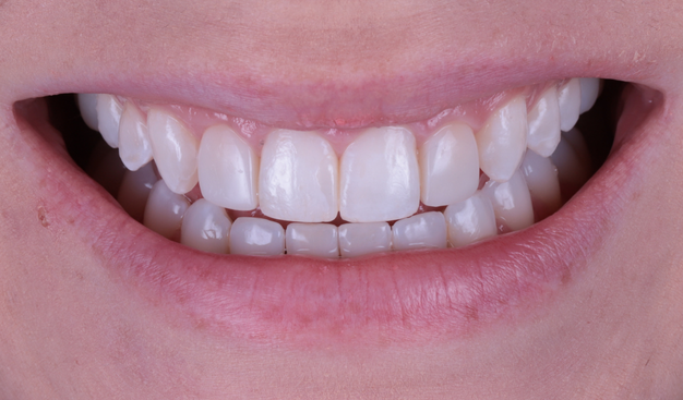 After -Dr Nina Shaffie