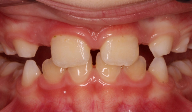 After -Dr Nina Shaffie