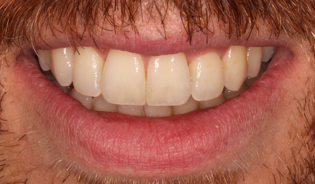 After -Dr Nina Shaffie