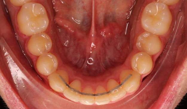 After -Dr Nina Shaffie