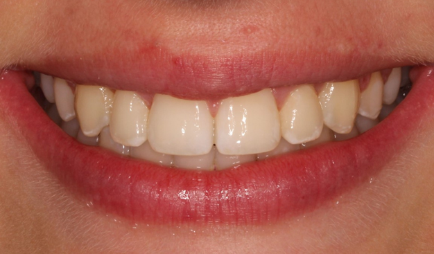 After -Dr Nina Shaffie