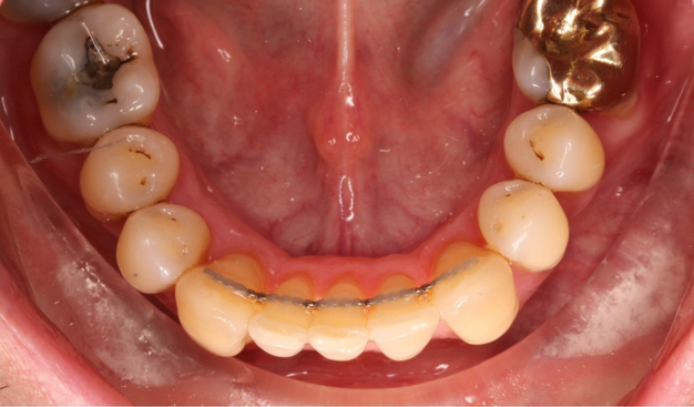 After -Dr Nina Shaffie