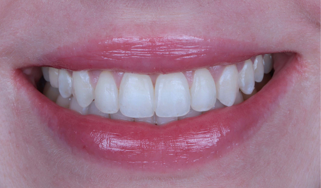 After -Dr Nina Shaffie