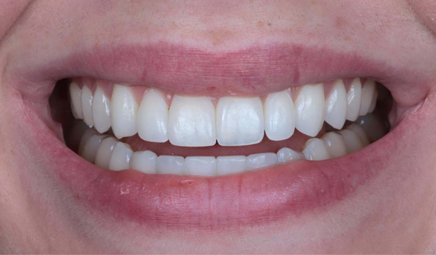 After -Dr Nina Shaffie