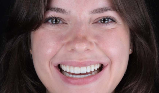 After -Dr Nina Shaffie