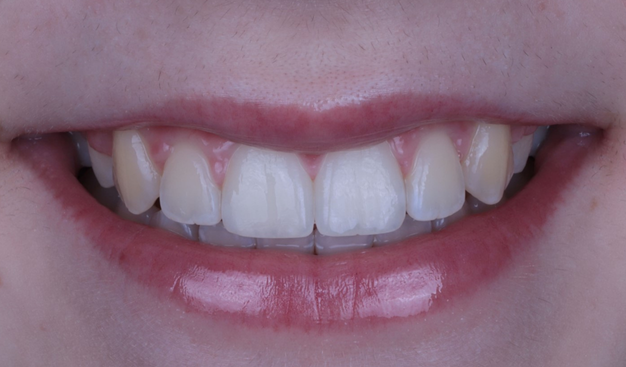 After -Dr Nina Shaffie