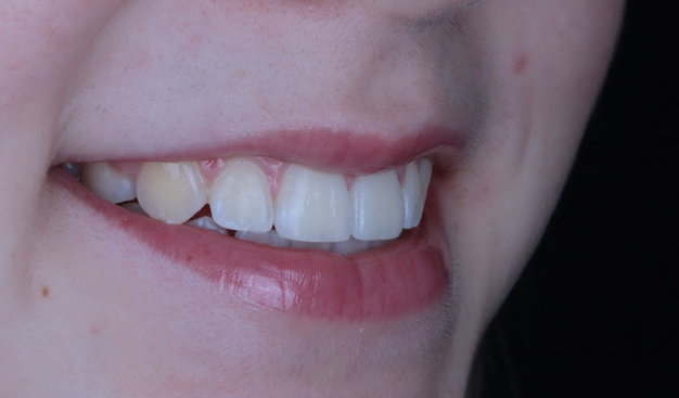 After -Dr Nina Shaffie