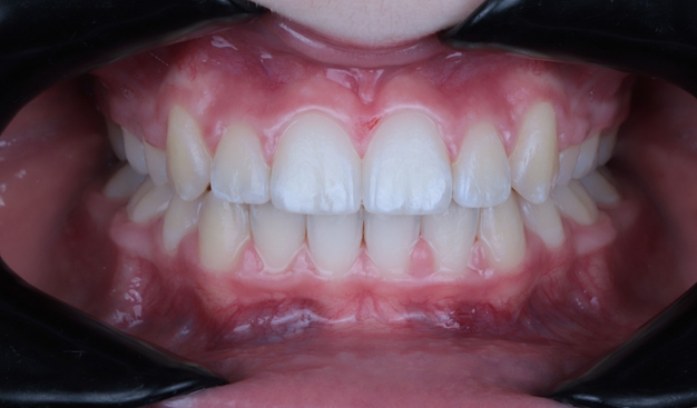 After -Dr Nina Shaffie