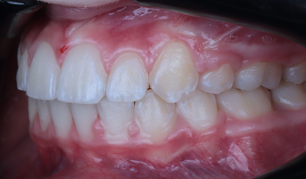 After -Dr Nina Shaffie