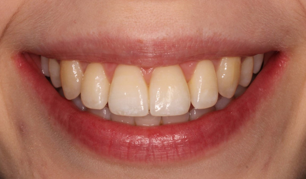 After -Dr Nina Shaffie