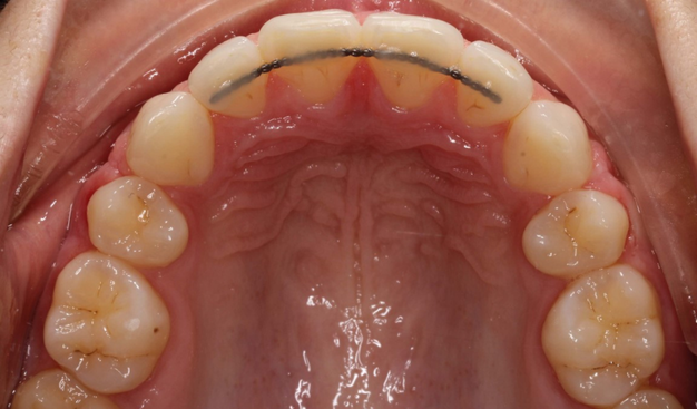 After -Dr Nina Shaffie