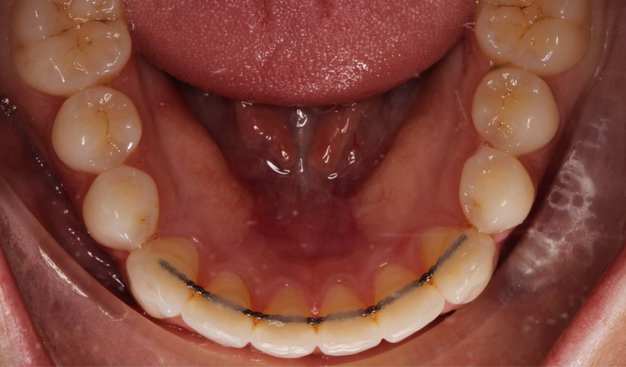 After -Dr Nina Shaffie