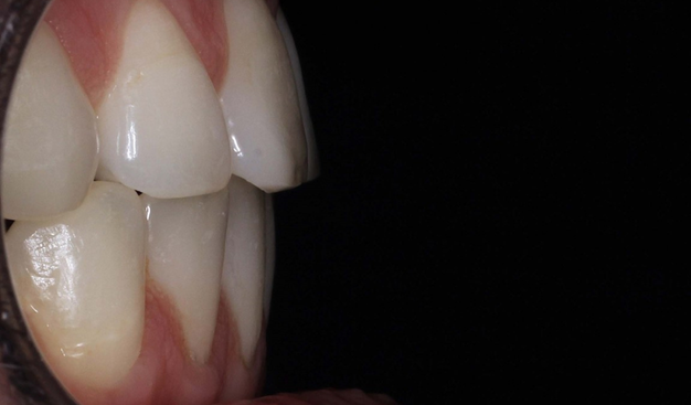 After -Dr Nina Shaffie