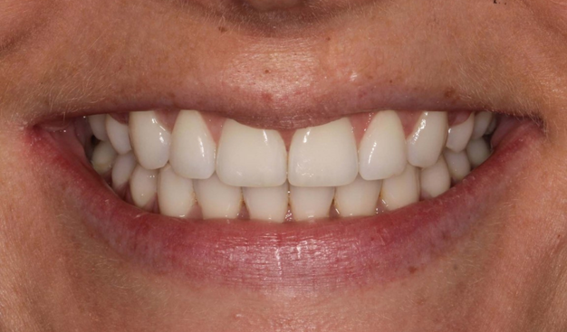 After -Dr Nina Shaffie