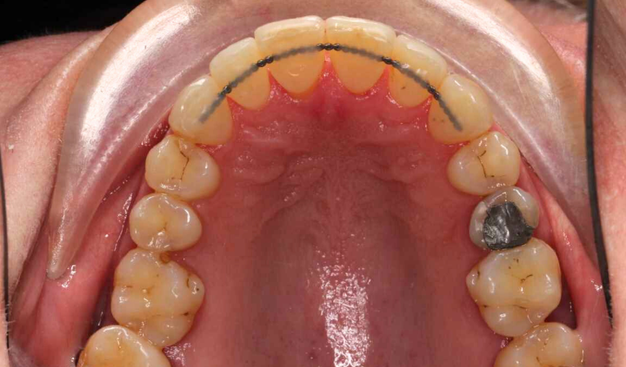 After -Dr Nina Shaffie