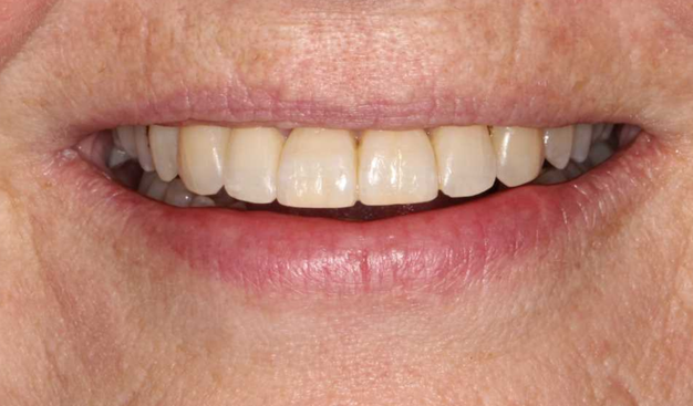 After -Dr Nina Shaffie