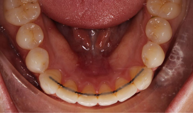 After -Dr Nina Shaffie