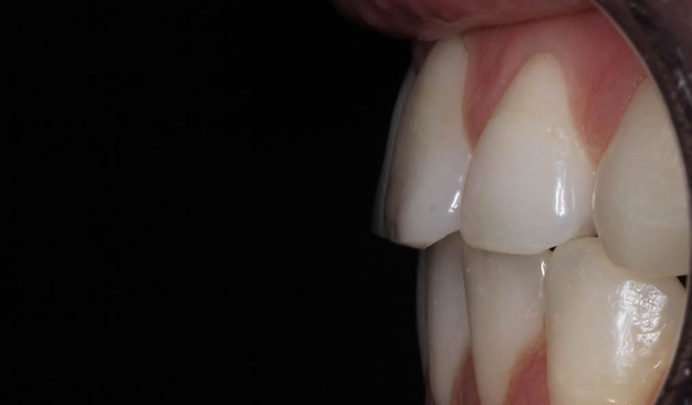 After -Dr Nina Shaffie