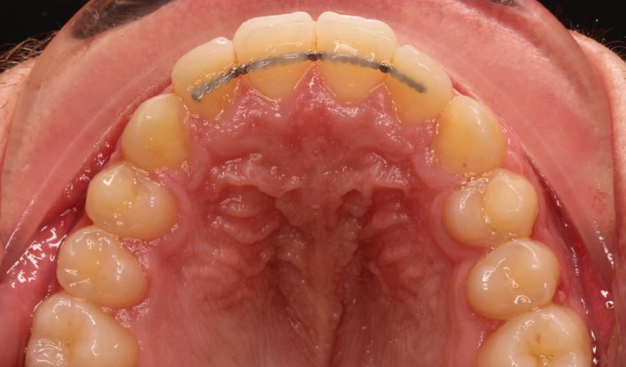 After -Dr Nina Shaffie