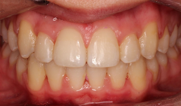 After -Dr Nina Shaffie