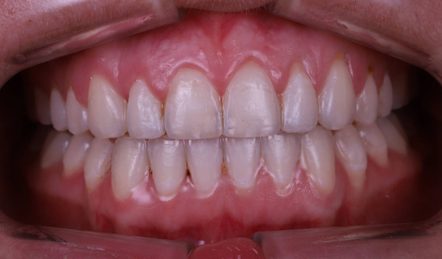 After -Dr Nina Shaffie