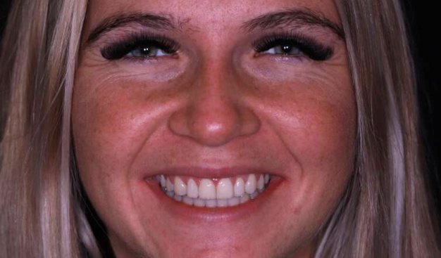 After -Dr Nina Shaffie