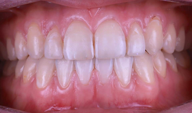 After -Dr Nina Shaffie