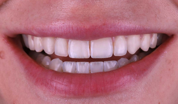 After -Dr Nina Shaffie