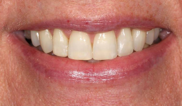 After -Dr Nina Shaffie