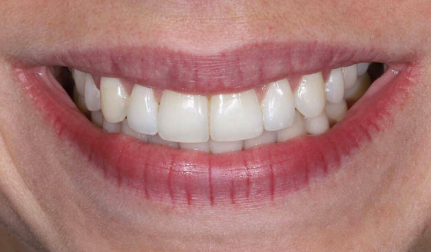 After -Dr Nina Shaffie