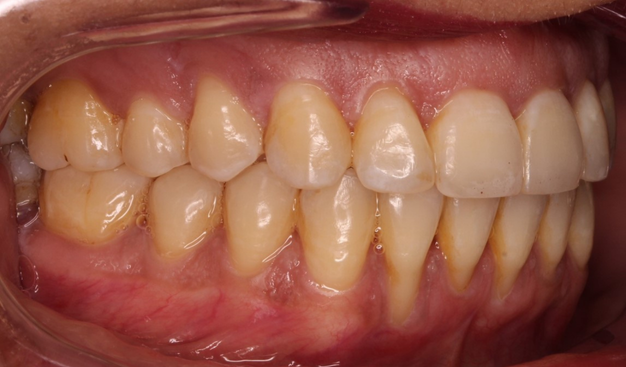 After -Dr Nina Shaffie