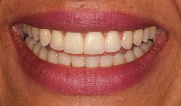 After -Dr Nina Shaffie