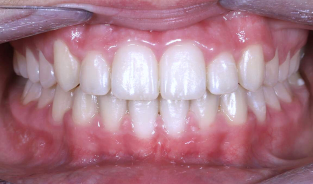 After -Dr Nina Shaffie